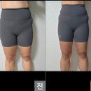 윤뷰티앤네일 | 윤뷰티앤네일))허벅지람스후 후관리로 크레이지015