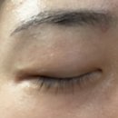 만능사 | 청담동 속눈썹영양제 피코래디스 골든루틴앰플 사용 후 길이,굵어졌다