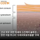 국화솔루션
