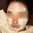유주왕외과의원 | ✨[신부관리①] 울쎄라/리쥬란 내돈내산 후기(통증/효과/붓기) ｜신사역 리브 성형외과