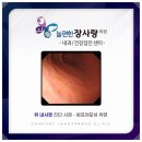 늘편한장사랑의원 네이버블로그