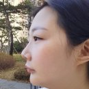 겨울철 푸석한 고민은 홈케어기기 약손벨라 갈바닉 뷰티디바이스로 해결