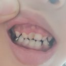 서울로뎀치과의원 이미지