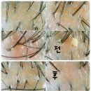 에제르 | 두피 케어샵 에벤에제르 스캘프 신천점 내돈내산 후기