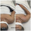 에이원케어메디컬 | 두산동 바디경락,수성구 웨딩케어 추천은 에이원뷰티추천해요