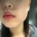 브랜뉴의원 네이버블로그