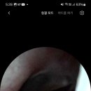 열린이비인후과의원 이미지