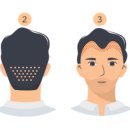 모래내피부과의원 이미지