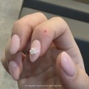 강남피부과의원 | 울산 손가락습진 디푸코연고 내돈내산후기 동구 일산지 강남피부과의원