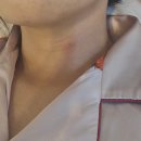 호스텔 클로이 | 7월달 한국 간 걸 내가 어 떻 게 기억하냐고 - 1. 갑상선 총생검 누가 미리 총으로 쏘는 거라고 말해...