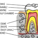 손상 치아 치료방법. 법랑질파절, 치관파절,치근파절,치아탈구,치수손상 이미지