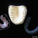 센트럴치과의원 네이버블로그