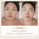 늘 에스테틱 - 진주시 | 늘,예쁜 에스테틱에서 프리미엄 스노우 테라피 관리 받은 후기