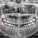 지하철 개금역(부산백병원) 이미지