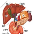 담낭암 이미지