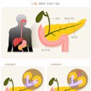 췌장을 살리는 기술. 이미지