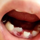 서울웃는아이소아치과의원 이미지