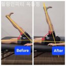 목동PT 힐링인피티 이미지