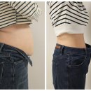 현재 체지방만!! -9.5kg / 혜화역 러브핸들 지방흡입 후기