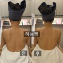뷰티&스넥 | 판교 바디관리｜올가드림뷰티 판교고등점 목·어깨 결림 관리 후기