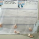 서울내과의원 | 서울 양천구 일요일 진료하는 곳, 서울내몸케어내과의원 일요일 내시경 검사 후기