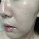 카밍 | 각질 쏘옥 빼는 야다 아줄렌 카밍 클렌징밤 솔직후기