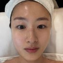 모란역피부관리 :) 오라스킨케어 파워트리 얼굴비대칭 관리 대만족 후기
