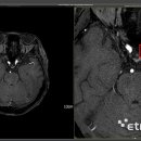 청구의료기 이미지