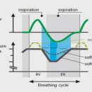 소프트안 이미지