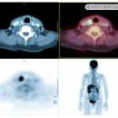 CT, MRI, PET-CT의 차이점과 목적은 무엇인가요 ? 이미지