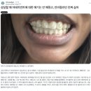 드림치과기공소 | [그래피 설명회 시리즈 1편] 소비자 편 '그래피 SMA'를 선택할 수밖에 없는 이유