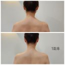 요거트월드포항문덕점 | [포항 웨딩관리] 제대로 리프팅 받고 날씬해지기 <뷰티앤맘 포항문덕점 후기