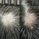 그로우모모 두피 탈모 케어센터 이미지