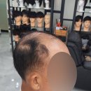 김호증모가발다온헤어