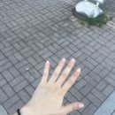 손톱에바나나 | 강동경희대 담낭절제술 후기 (담석, 선근종증, 담낭염)