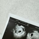 우종진산부인과의원 | [엄마 깅밍징 기록] 7주차 : 첫 심장소리 / 질정 처방 / 산전검사 / 임신바우처 신청