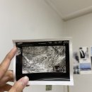 출산일기|현대해상 태아보험 내돈내산 가입 후기…(사은품 빵빵 설계사 추천✨)