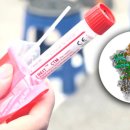 에스디바이오센서(주) 이미지