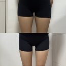 일상 | 천호역 지방추출주사 잘하는곳 | 허벅지 관리 2주차 일상 후기