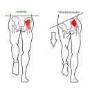 하이핏짐 이미지