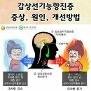 갑상선 기능 항진증 증상 원인 개선방법 이미지