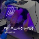 [하이푸스 춘천온의점] 춘천발각질 무좀발톱 스케일링 후기