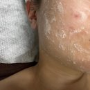 서대문피부관리 '리안스킨케어'에서 새로운 윤곽관리 기계 맛보기
