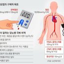 가족력 무시 못하는 당뇨… 식습관 바꿔 체중 줄여라 이미지