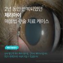 체리메이 | [메이, 치료후기] 반복되는 강아지 체리아이, 매몰법으로 수술한 치료 케이스
