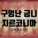 연세돌담치과의원 네이버블로그