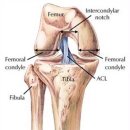 [무릎통증]십자인대파열 증상과 치료법 이미지