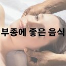 부종에 좋은 음식 호박 바나나 이미지