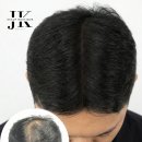 제이케이두피부띠크(JK두피부띠크)