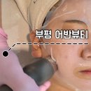 뷰티홀 에스테틱 | 인천 부평 어반뷰티ㅣ여드름·모공 관리 전문 에스테틱 천방샷 후기 (모공 관리 효과는?)